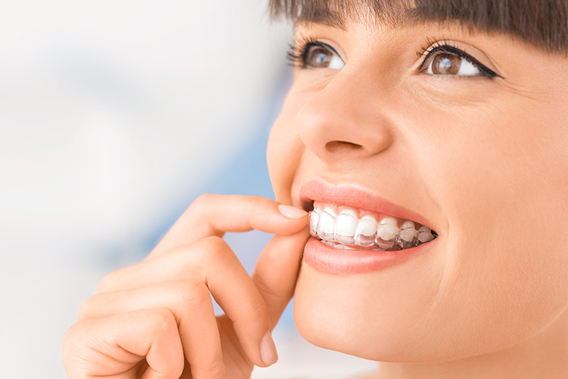 Invisalign in Suwanee