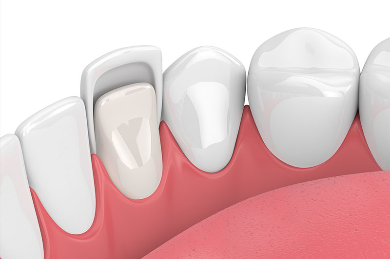 Quality Dental Treatments in Suwanee